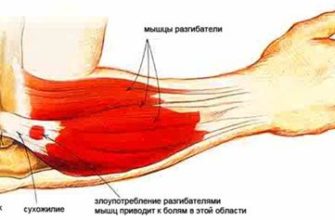 Острая боль в левом локтевом суставе - причины и лечение