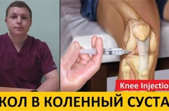 Сладкое и боль в суставах