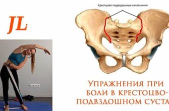 Проблемы суставов при бодибилдинге - почему возникает боль и как избежать ее