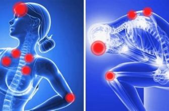 Как избавиться от боли в плечевом суставе - эффективные методы