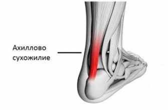 Болезненные ощущения в боковой части коленного сустава