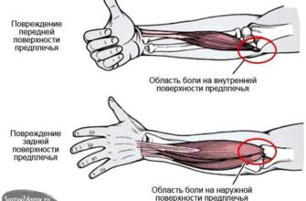 Почему болят и опухают суставы - причины и лечение