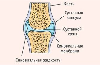 Боль в коленных суставах у пациентов с ВИЧ - причины и лечение