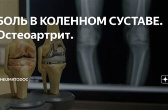 Озноб при болях в суставах - причины и способы облегчения