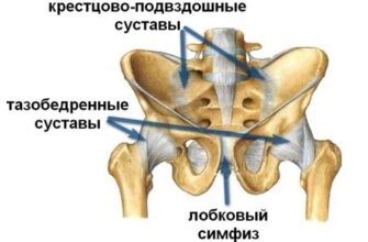 Как снять боль в суставах с помощью холода